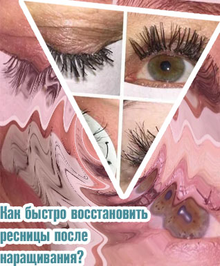 Как быстро восстановить ресницы после наращивания форум