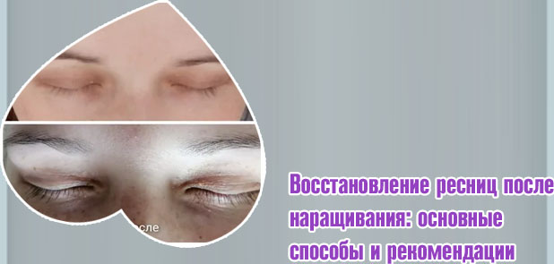 Как восстановить ресницы после наращивания