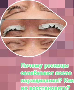После наращивания ресниц как восстановить свои